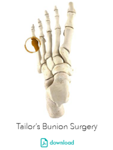 Tailor’s Bunion Surgery Perth - Perth Podiatric Surgery