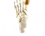 Podiatric Surgery Perth - Big Toe Joint Arthritis Surgery Perth - Logo