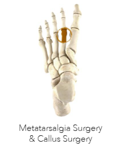 Podiatric Surgery Perth - Metatarsalgia Surgery & Callus Surgery Perth - Logo