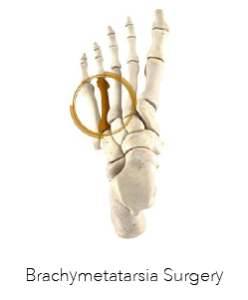 Podiatric Surgery Perth - Brachymetatarsia Surgery Perth - Logo