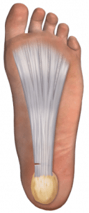 Heel Pain