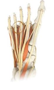 Morton's Neuroma Surgery Perth - Foot Surgeon Perth - Perth Podiatric Surgery