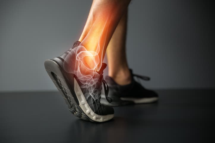 ankle specialist perth, treating ankle pain with surgery