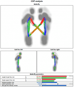 rehabilitation after foot surgery